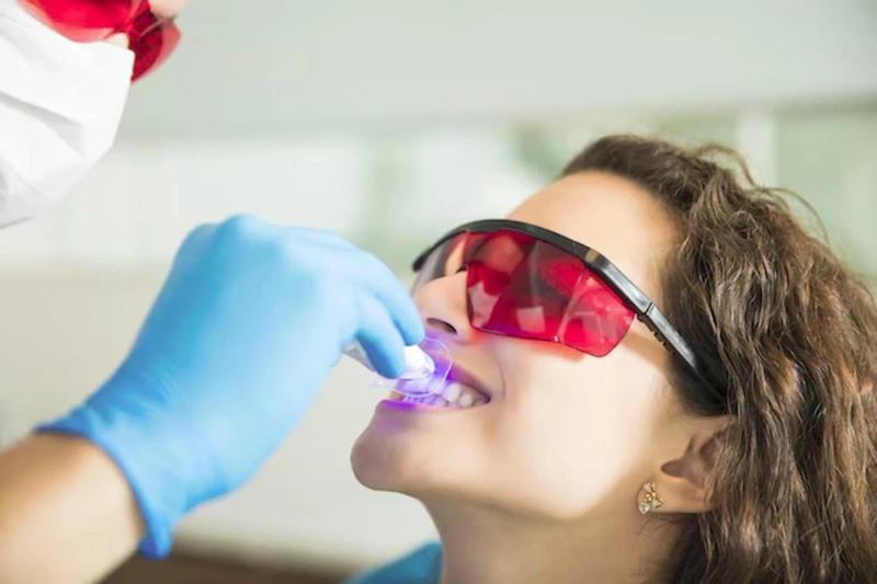 Teeth Whitening Richmond: In-Office vs. At-Home Options