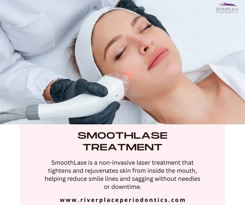 SmoothLase: The Inside-Out Lip Plumper