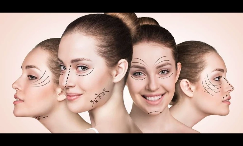 Face Lift Surgery at Dr. Monisha Kapoor Aesthetics 