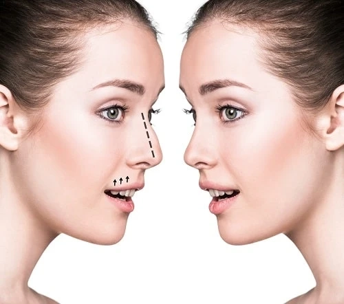 Popular Plastic and Cosmetic Surgeries For Body Contouring
