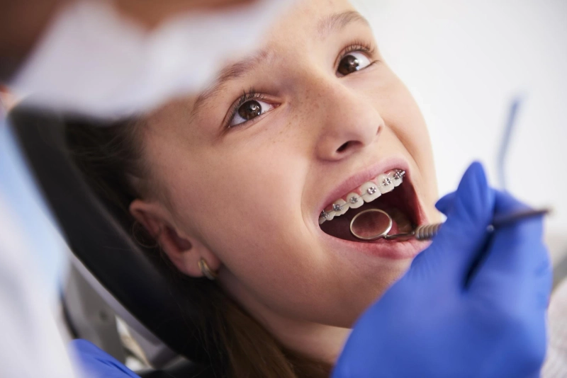 Invisalign Treatment Cost Explained: What You Pay And Why