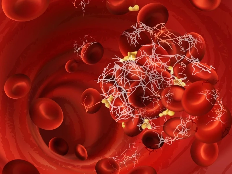 Navigating the Hemophilia Disease Market: An In-Depth Analysis