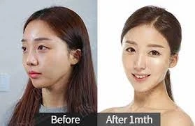 Choose The Well-Known Clinic To Receive The Best Plastic Surgery In Korea