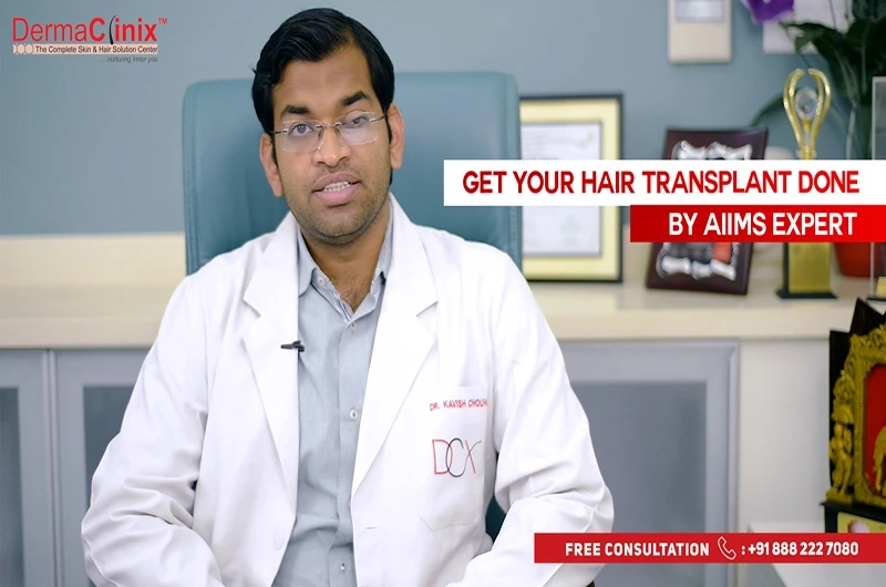 Get the Best Recovery After Hair Transplant Surgery