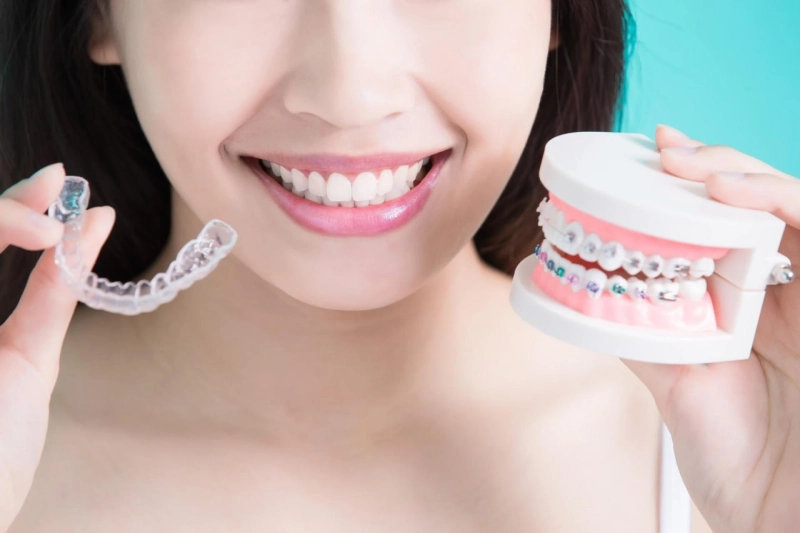 Hidden Braces: A Discreet Orthodontic Solution in East Hanover