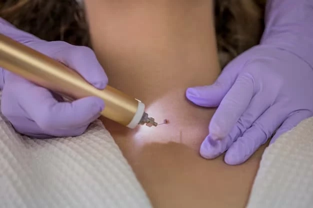 Skin Tag Removal Explained: Causes, Safe Treatments and When to See a Doctor