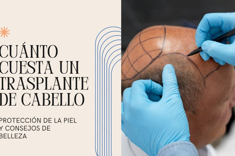 Cuánto Cuesta un Trasplante de Cabello