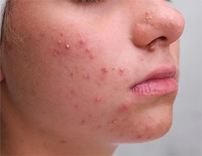 Beyond the Surface: Understanding the Mind-Body Connection in Skincare