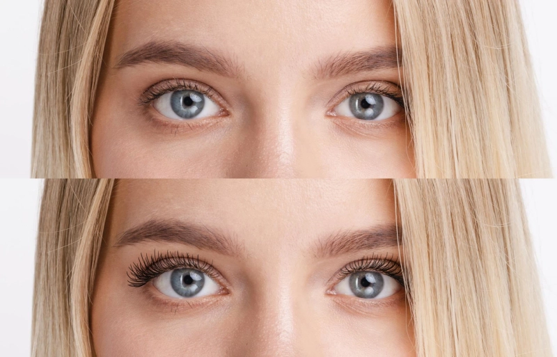 When Are Eyebrow Botox Before and After Results Most Noticeable?