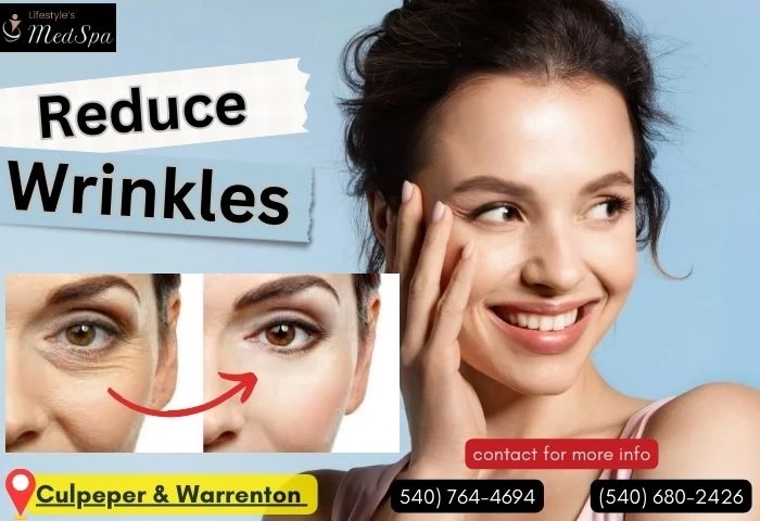 Discover the Secret to Youthful Skin: Wrinkle Filler Treatments