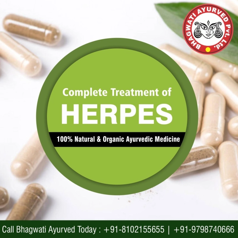 Get the natural herpes treatment in India!!