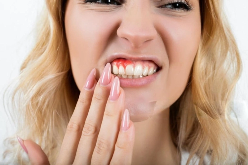 How Many Appointments Does It Take to Treat Gum Disease?