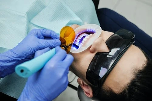 Complete information about Dental Crown
