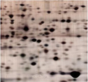 Comparing 2D Electrophoresis vs. SDS-PAGE for Protein Analysis Provided