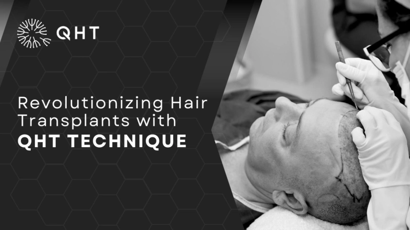 Hair Transplant in Delhi: The Real Guide to Fuller Hair Again