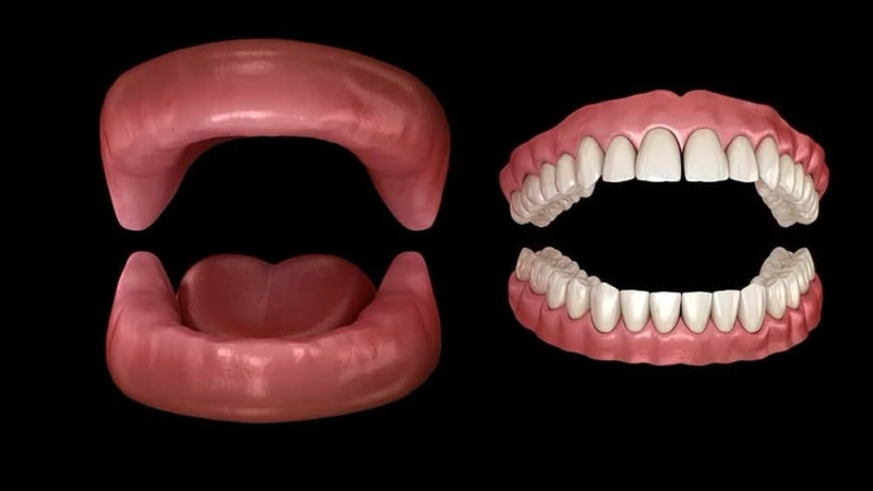 Dentures are prosthetic devices that are used to replace missing teeth