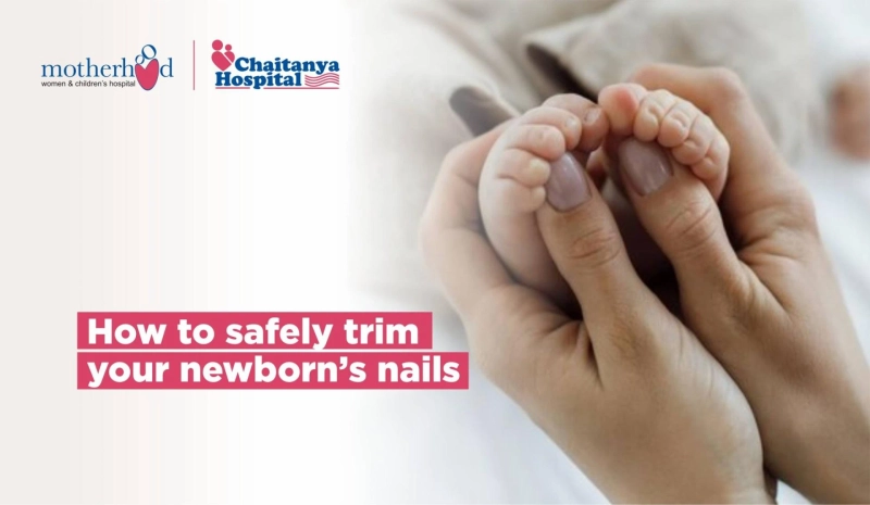 How to trim Newborn Nails.?: Tools, Step-by-Step Guide to Safe Nail Trimming