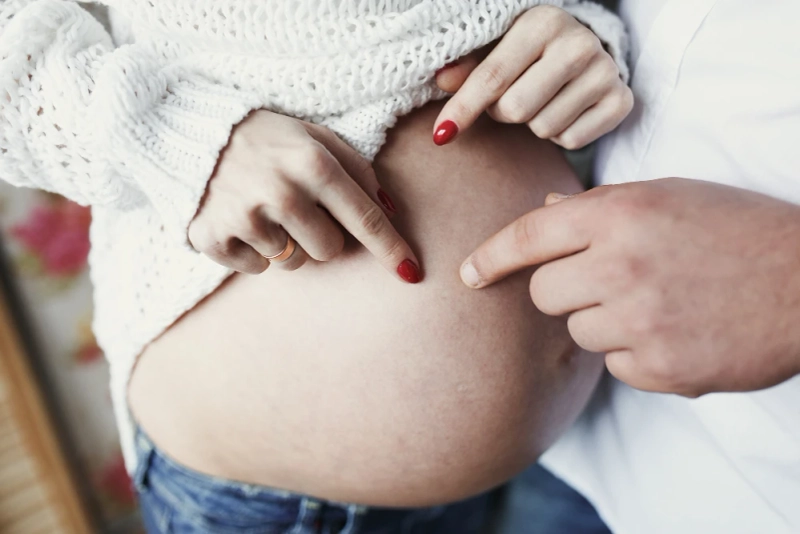 Understanding the Causes of Stretch Marks During Pregnancy and How to Minimize Them