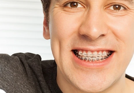 Finding Trusted, Affordable Orthodontic Care in Las Vegas