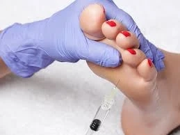 What is foot cushioning dermal filler?