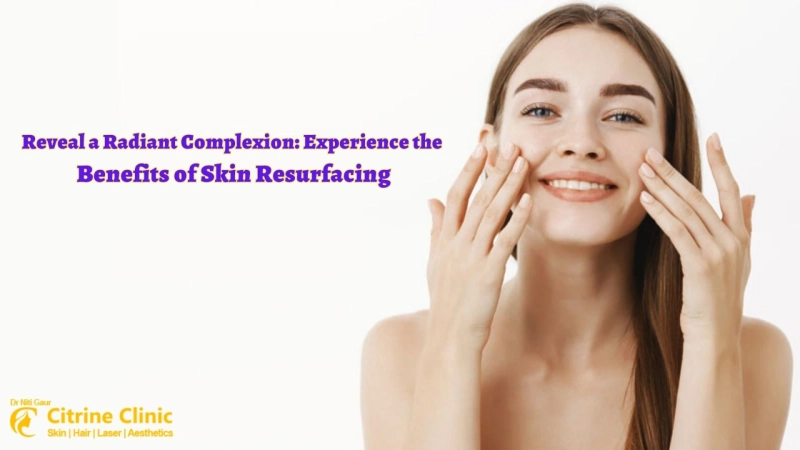 Reveal a Radiant Complexion: Experience the Benefits of Skin Resurfacing