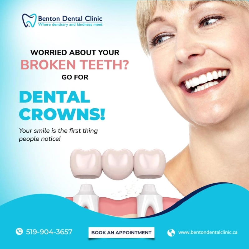 Crowns and bridges in Kitchener | Best Dental Office in Kitchener - Benton Dental Clinic