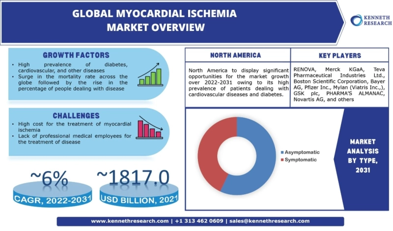 Myocardial Ischemia Market Size with Growth Opportunities, Top Countries Data, Future Trends