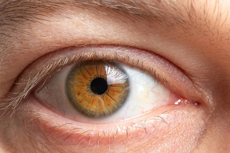 Benefits of Eyelid Surgery Beyond Aesthetics