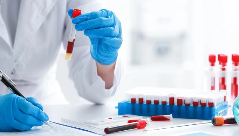 Mobile Laboratory Services | Convenient At-Home Diagnostic Testing