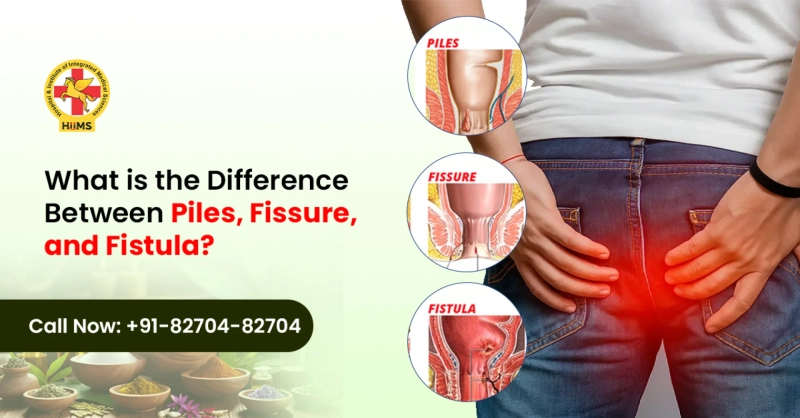 Piles vs Fissure vs Fistula: Symptoms, Causes, and Treatment Insights