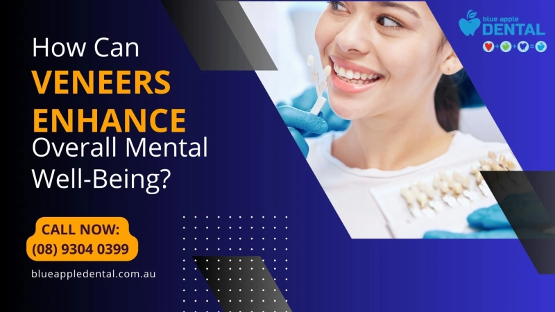 How Can Veneers Enhance Overall Mental Well-Being?
