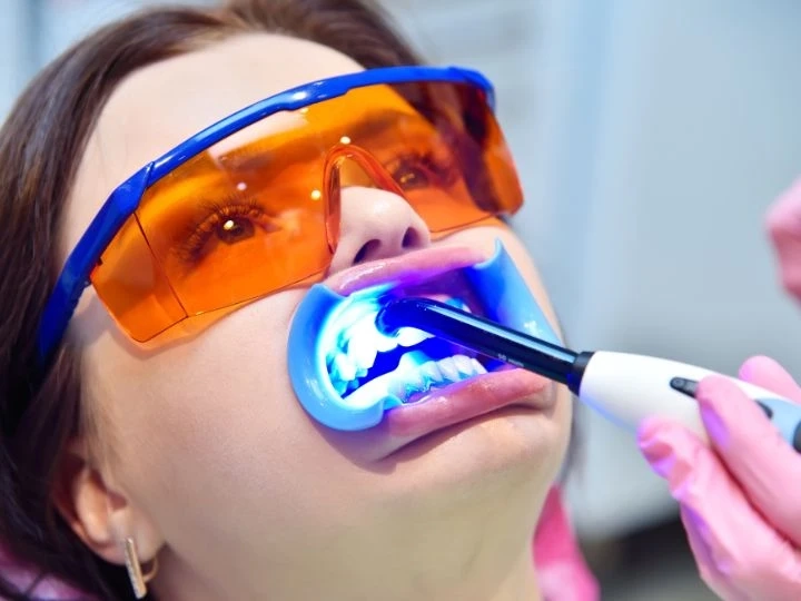 How Often Will You Need Touch-Ups After Paying Teeth Whitening Price?