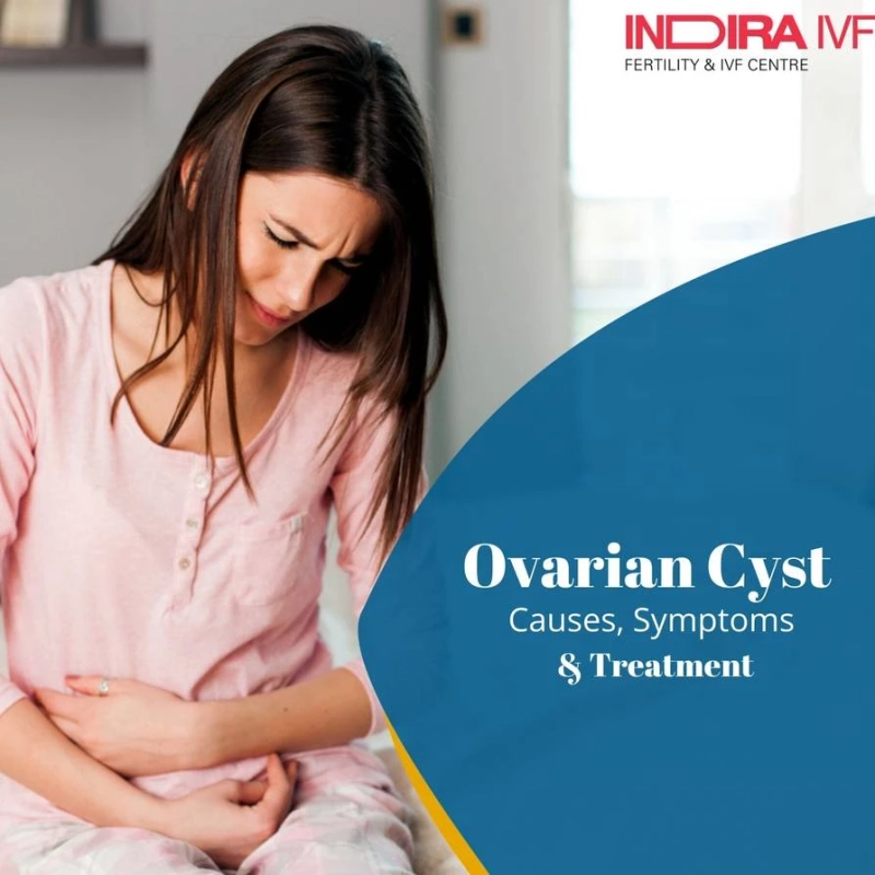 An A TO Z Guide to Ovarian Cyst