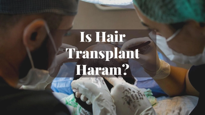 Is Hair Transplant Permissible in Islam? A Comprehensive Guide