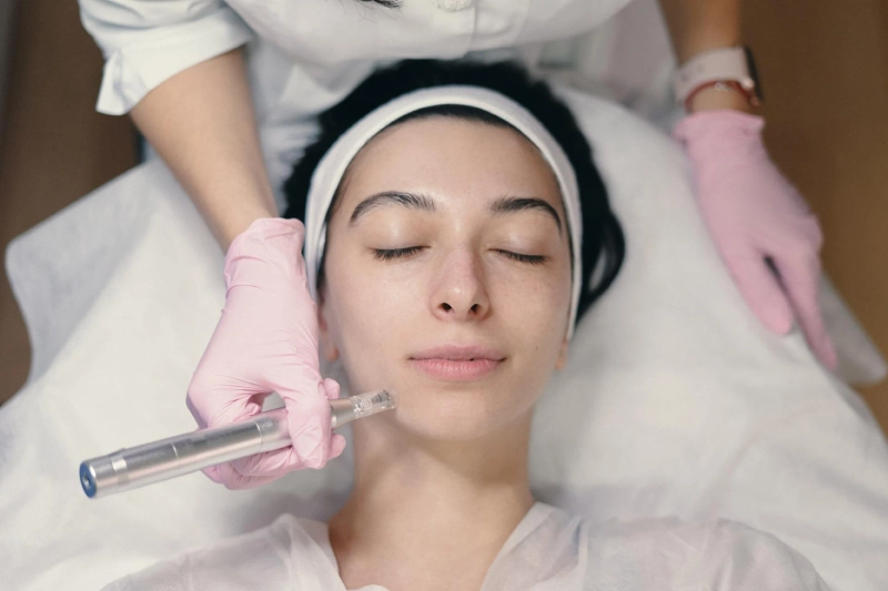 Clearer Skin Starts Here: Why Acne Scar Treatment in Korea Is Worth the Trip