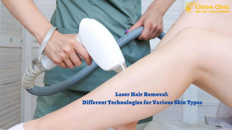 Laser Hair Removal: Different Technologies for Various Skin Types