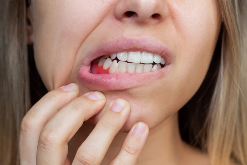 How Can You Improve Your Gum Disease Treatment?