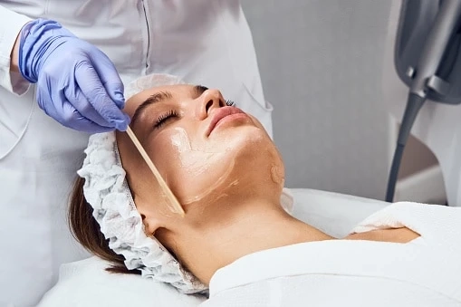 Here’s everything you need to know about Chemical Peels