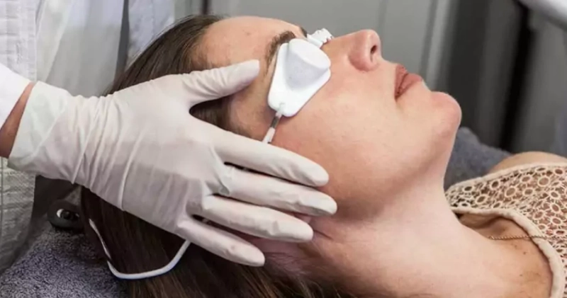 Laser Treatment Cape Town & Aesthetic Clinics Cape Town: A Comprehensive Guide