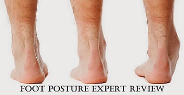 Foot Posture Expert Review