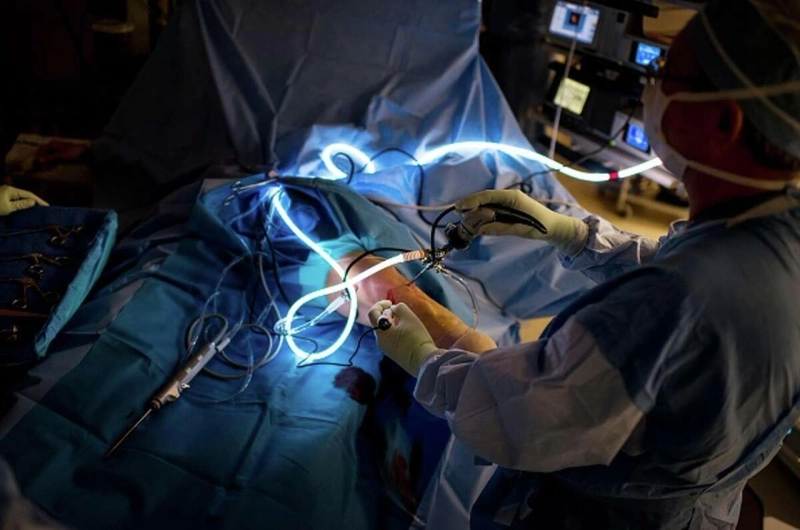 Arthroscopy Procedures and Products Industry Is Growing Due To Rising Awareness And Adoption Of Thes