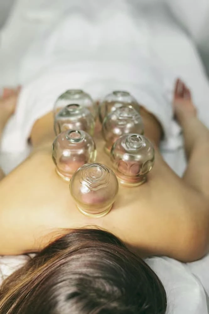 Cupping Therapy in Buffalo for Pain Relief and Muscle Recovery