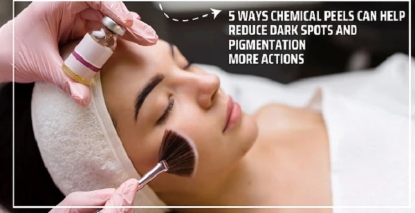 Rejuvenating Skin with Gentle Peel Treatments