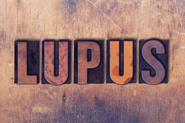 Navigating Lupus: Business Opportunities in Personalized Medicine and Targeted Treatments