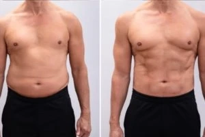 Diet Vs. Exercise: Benefits Of Diet For Weight Loss
