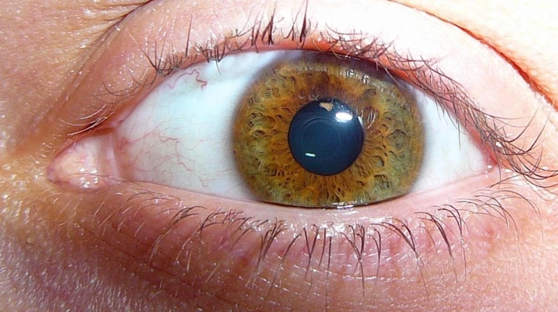 Eye Melanoma - Symptoms, Causes, and Treatment
