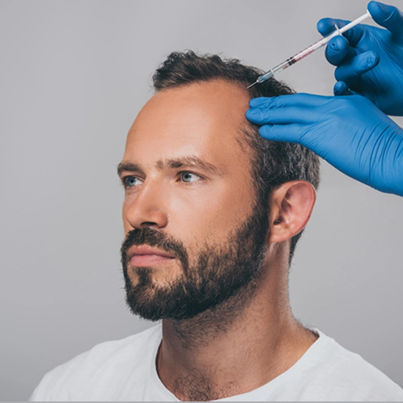 Achieving Hair Growth Goals A Cost Analysis of PRP Treatment in Dubai