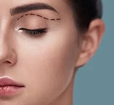 Eyelid Surgery vs. Non-Surgical Options in Cape Town