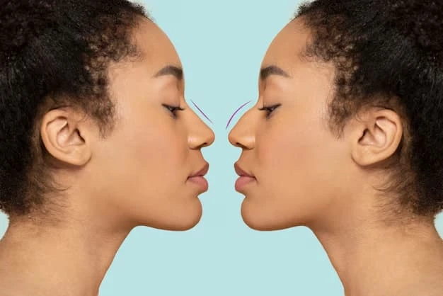 Revision Harley Street London Rhinoplasty: What You Should Know