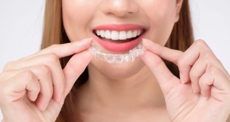 Who Is the Best Orthodontist for Invisalign? Discover Effective Invisalign Treatments
